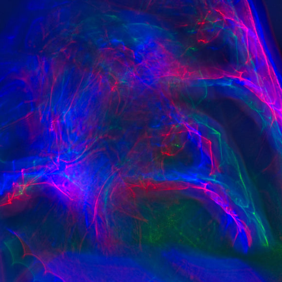 Abstract 004 - S