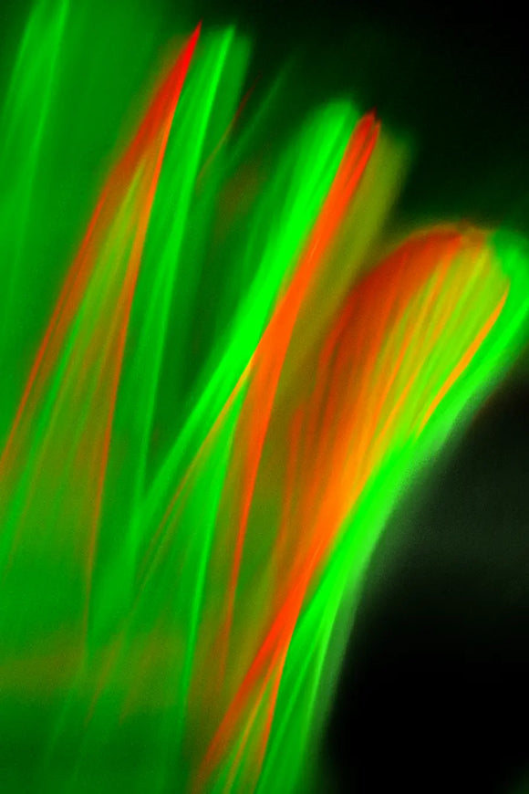 Abstract 14